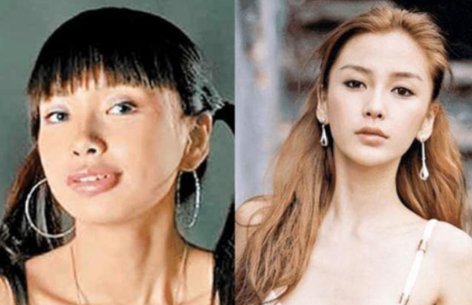 傅园慧|有种“整容”叫傅园慧,整牙后颜值飙升成女神,相信baby的话了