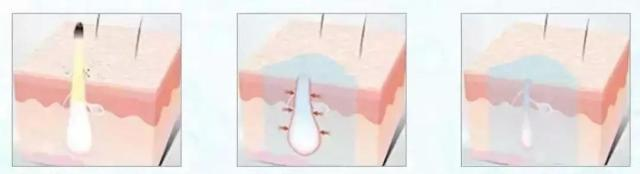 好物官|继“百雀羚”后，中国又一“平价”护肤品火了！高质低价力压兰蔻