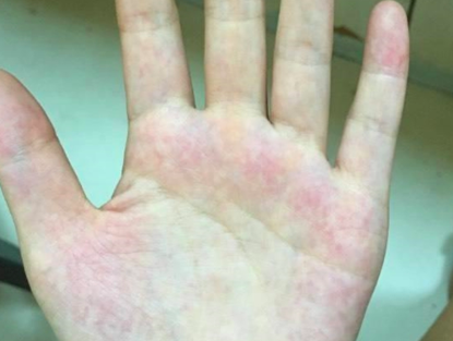 天天听健康|吃1口等于9斤绿豆，呼吁：这一“解毒”高手可常吃，肝脏会感激你的