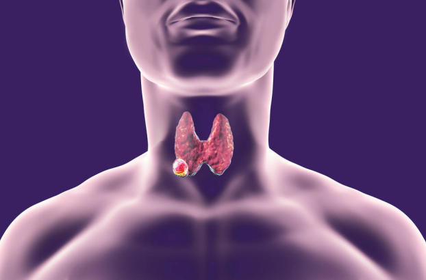 苦瓜|甲状腺“守护神”被揪出，苦瓜未上榜，榜首天天吃，结节慢慢消散