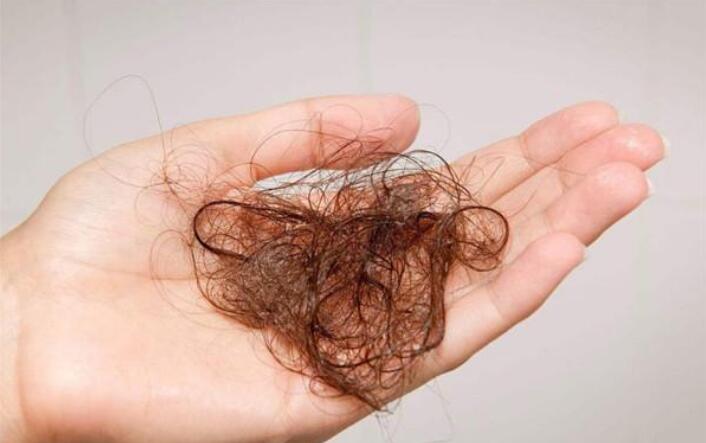 王菲|头发刚打湿就挤洗发水？难怪天天洗头还出油，教你洗头的正确方法