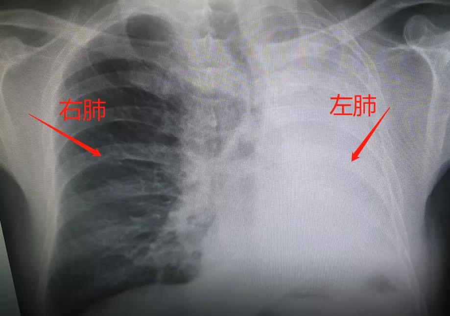 39健康网|吃一口等于10斤血旺,呼吸科医生:肺不好的人常吃,肺或能红润如初