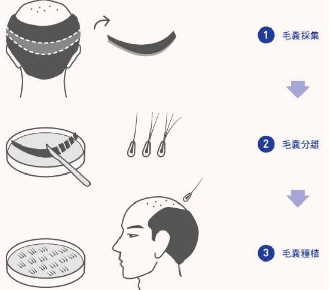 洗发水|头发刚湿透就抹洗发水？难怪一天不洗就出油，学学正确的洗发方法