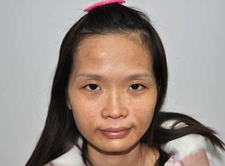 贫血|十个女生九个贫血，缓解缺铁贫血常可做3件事，不做“黄脸婆”