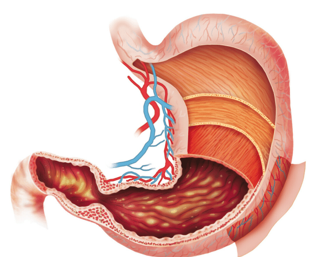 梦玉游戏|内科医生提醒：胃不好的人，3种水果要少吃，多吃2物，养胃更护胃