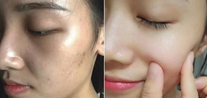 护肤|建议女生：在涂精华液时，记住“3不要”，让你的肌肤越养越白嫩