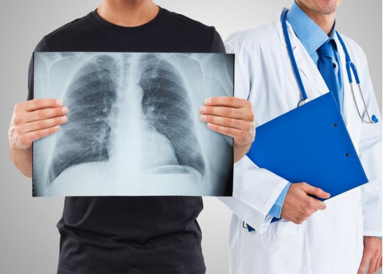 医生|肺科主任:开水中扔一把,没事天天坚持喝,结节“冲散”,肺或恢复正常