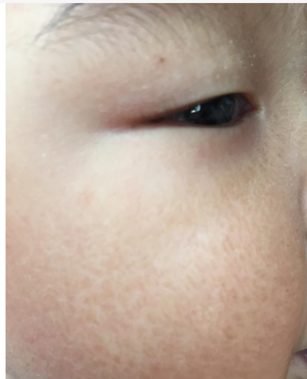 冬季护肤 冬季肌肤问题层出不穷？宝典在手，远离沙漠肌养成水光肌并不难！！