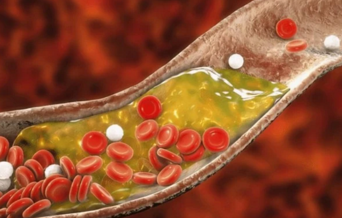 脾胃|吃一次相当于6斤山楂，内分泌医生：经常吃，或能养出“婴儿血管”