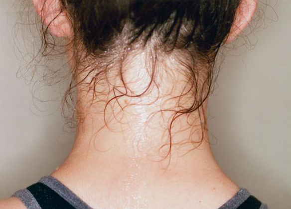 甲状腺肿瘤|爱吸烟的人,“睡觉”出现3异常,多半是甲状腺肿瘤,尽早检查CT