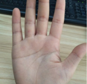 玄何师傅讲命理 手有“三角纹”的人，百年一遇，定是人中龙凤，早晚能成大器