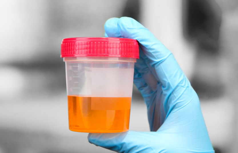 千金芳|男性早起若有4种“异常”，肝或已悄悄变“硬”，一个不占，肝还“强壮”