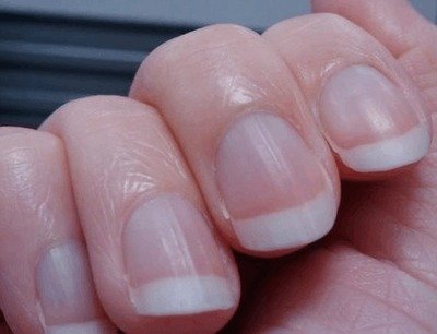 医线天|肝不好的人，从手指能看到蛛丝马迹，有3处异常不要大意