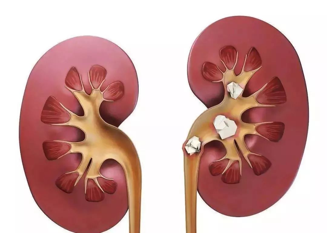 尿酸|小便后,低头看一眼,有3种现象,暗示尿酸在“飙升”,肾在慢慢受损