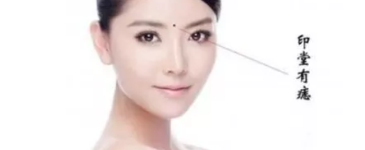 玄风命理|面相上不同位置的痣，寓意不同！