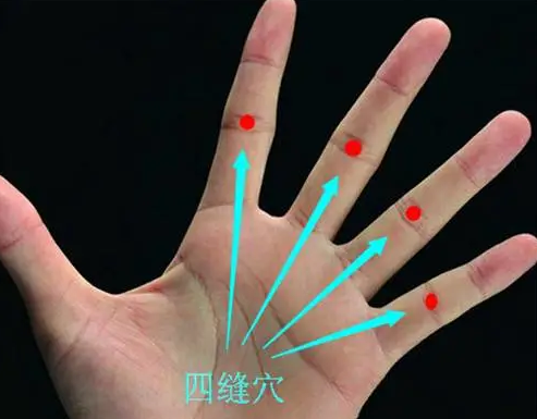 益奇健康科普|胃很“傲娇”，要少吃2种“发物”，除了酒，你还了解哪些？