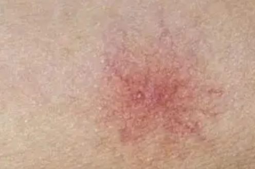 肝脏|让肝部容光焕发的不是菠菜，肝胆科主任：若你常吃，肝脏清洁柔嫩