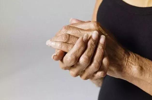 金兰中医学社|45岁男子，痛风入院，肾衰离世，医生：一把年纪，这事怎能放纵