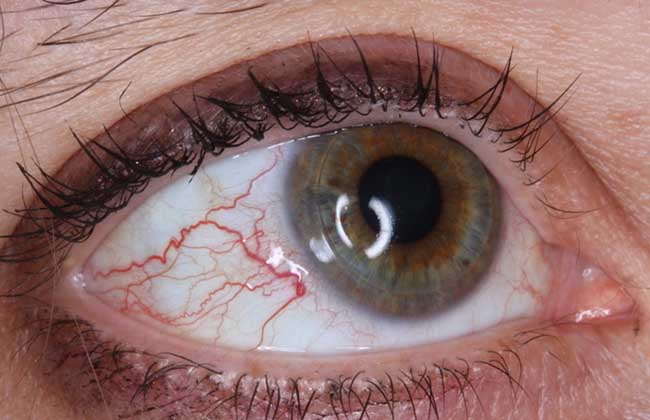 肝癌|26岁女子浑身瘙痒，2个月后查出肝癌，医生：身上2处发痒，早做肝CT