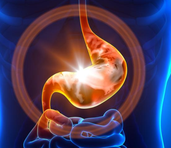 幽门螺杆菌|63岁张大爷幽门螺杆菌从93降至51，经验：日常坚持3件事，对胃好