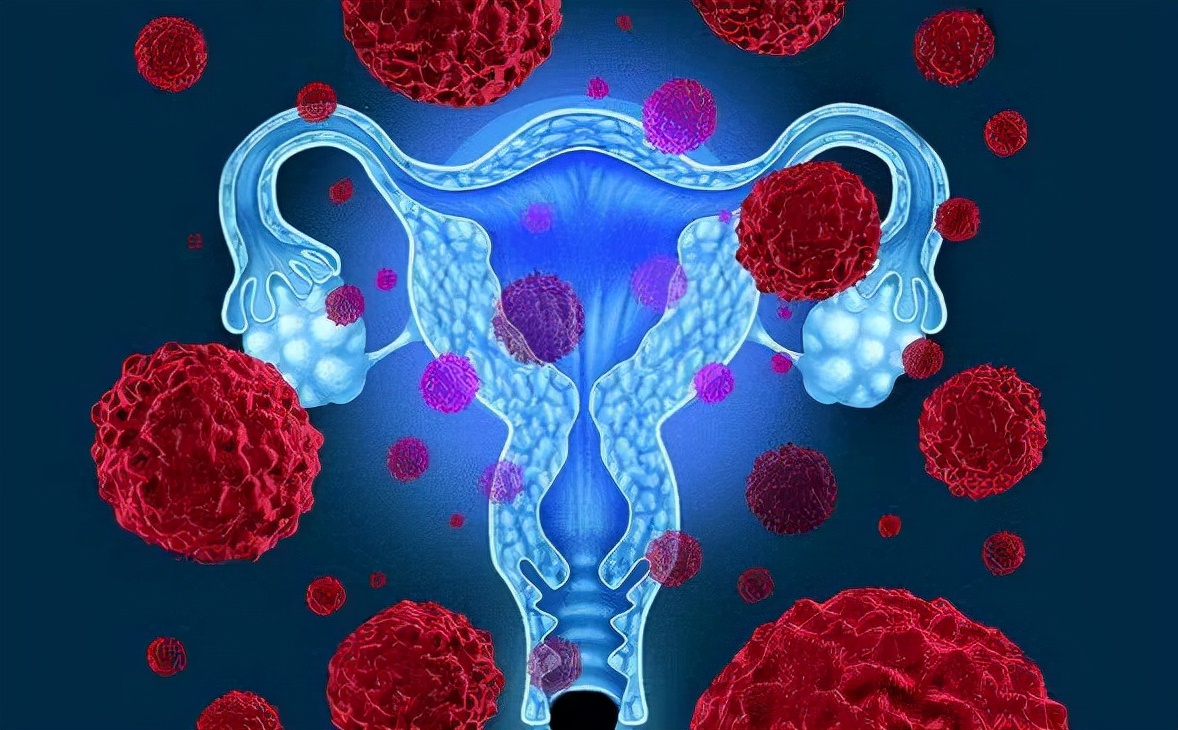 牛奶|感染HPV不能喝牛奶?医生:除了牛奶,这3物也不能多吃