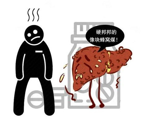 肝硬化|肝硬化的“推进器”已公布，肝不好的人，别忽视这4种异常变化！