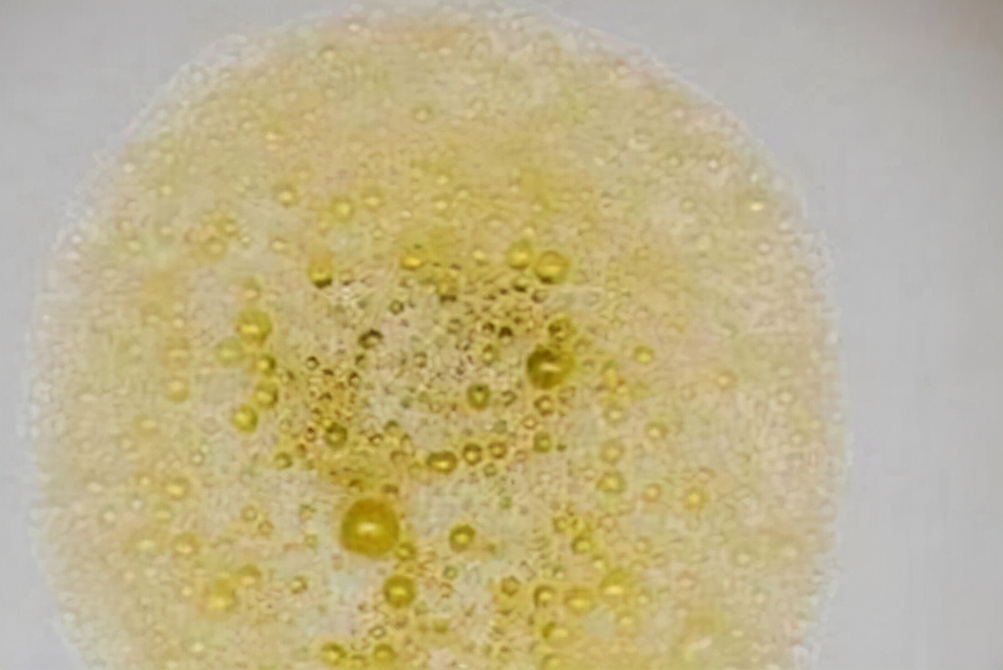 心肌梗塞|数名院士联合呼吁：停止使用“1热水壶”，小心肾衰找上门，趁早扔