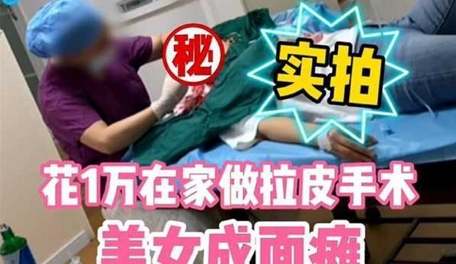 女子花一万在朋友家做拉皮手术,最终成面瘫,朋友无证被逮捕