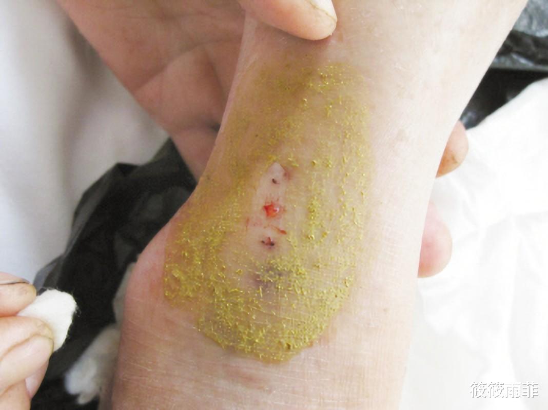 毒液 蛇的弱点你知道哪些?在野外碰到蛇该怎么做呢?