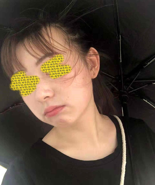 痘痘|不会“踩雷”的4款护肤品，卖不了高价钱，效果却不输大牌