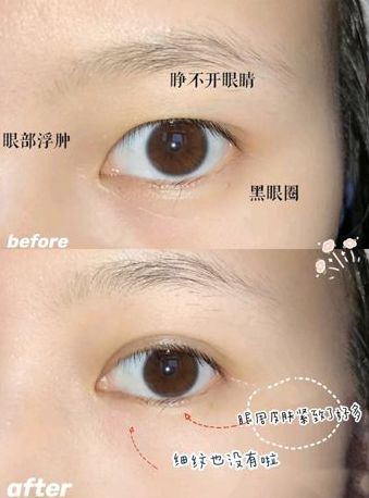 眼霜 即将停产的“国货”眼霜,却是甜妹最爱,田曦薇:星星眼全靠它