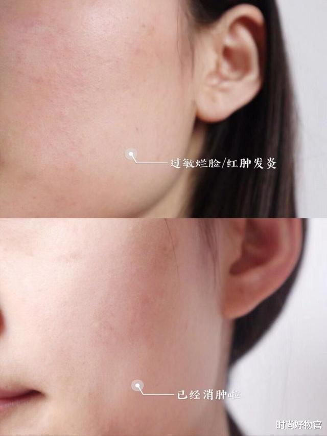 护肤 5个护肤小技巧,让你皮肤细腻有气质,肤质光滑水润,美丽且动人