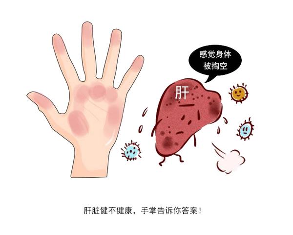快速问医生|血管老化的4个坏习惯，你有吗？做好3方面，有助养护血管