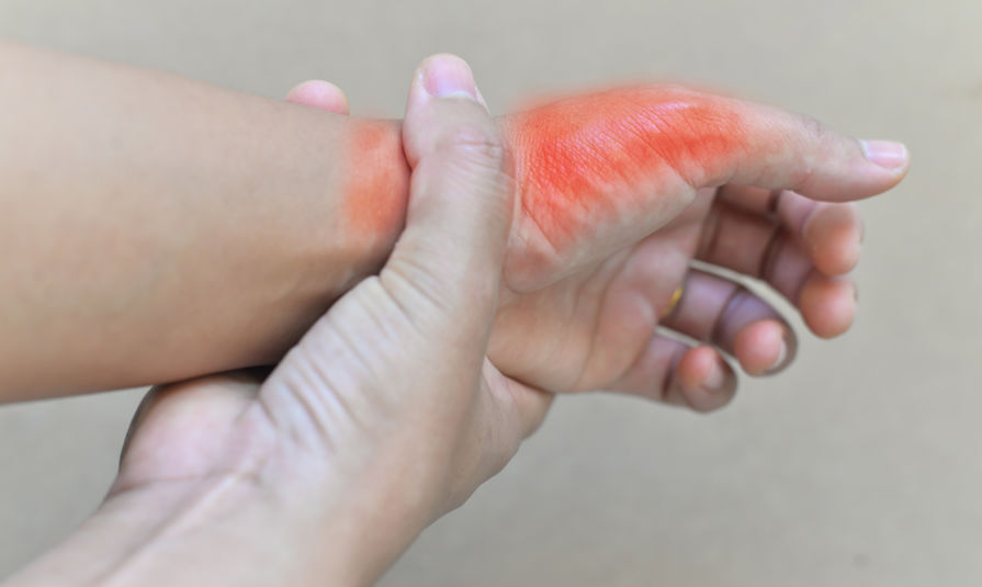 尿酸|尿酸超标时，身体或出现5种异常，若你有，要及时降低尿酸值