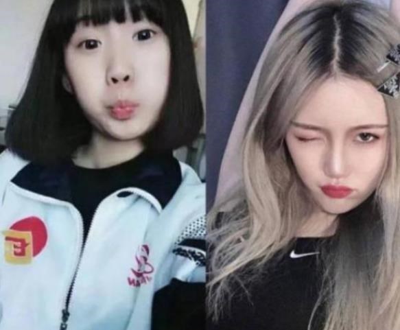 雪落无尘谈|考生在高考后选择“容貌改造”，到底是好事坏事？听听学姐怎么说