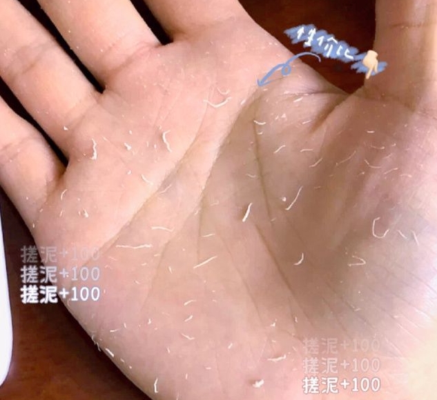 秀尚青依 二胎宝妈分享丨注意!孕期别盲目跟风网红身体乳,长毛还烂肤