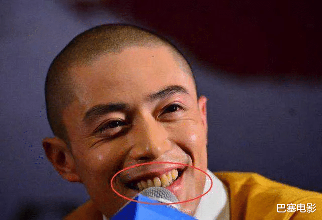 朱珠|发腮秃头、酒糟鼻、大肚腩，还有塑料僵脸，中年男星的辣眼震撼