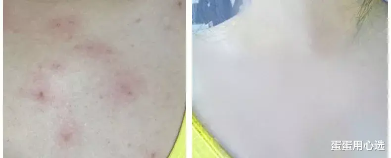 螨虫 奔三奔四的女人，身上有这5个特征，说明你老得慢，还年轻！