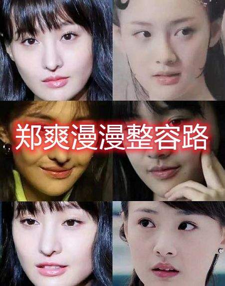 张柏芝|初见惊艳不已，再见路人甲乙！12个明星颜值成谜，这脸怎么了？