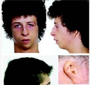 舜网 5岁女孩不到8斤，身高只有68cm，医生曾说她活不过1岁