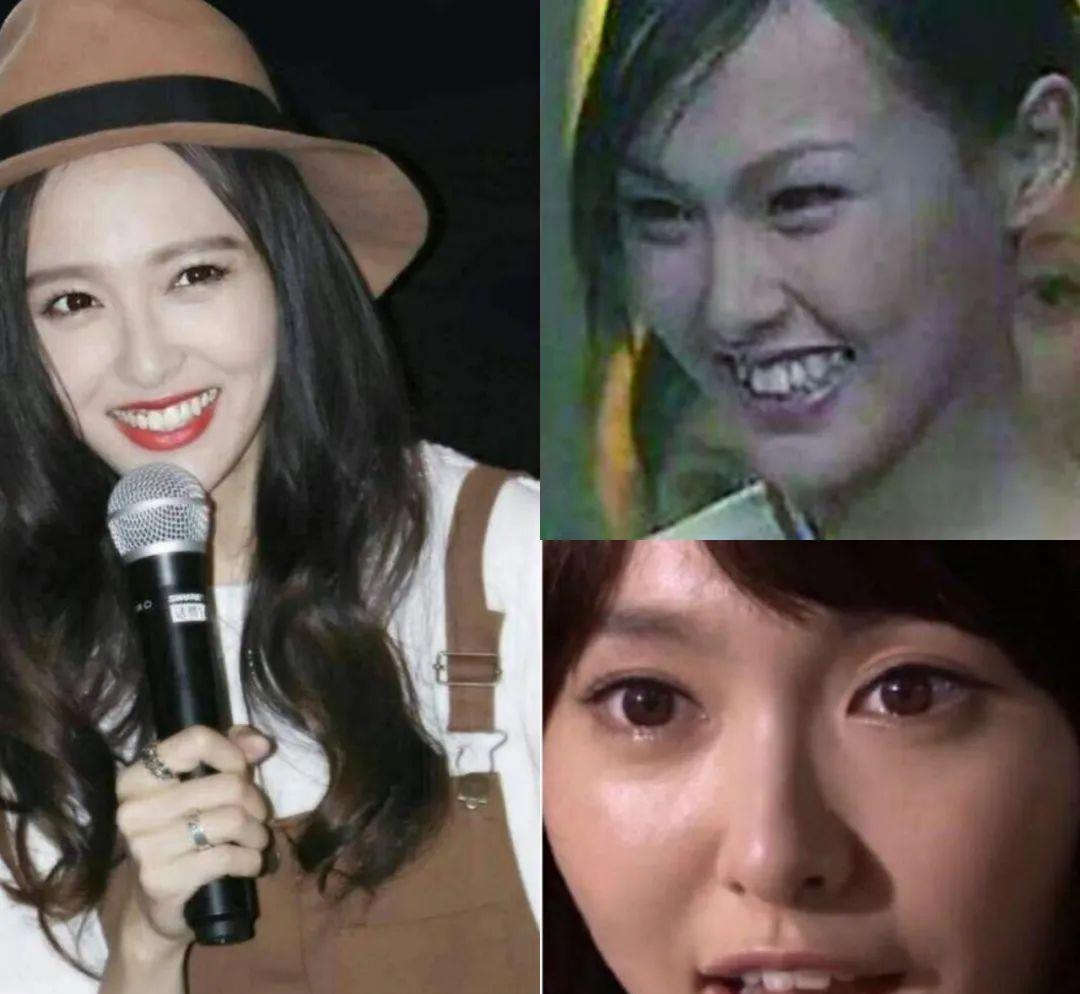 唐嫣|明星的一口乱牙，范冰冰唐嫣整牙后提升颜值，甘望星的牙齿需矫正