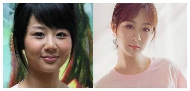 郭麒麟|明星减肥前后大对比,李现逆袭,郭麒麟成小鲜肉,魏大勋判若两人