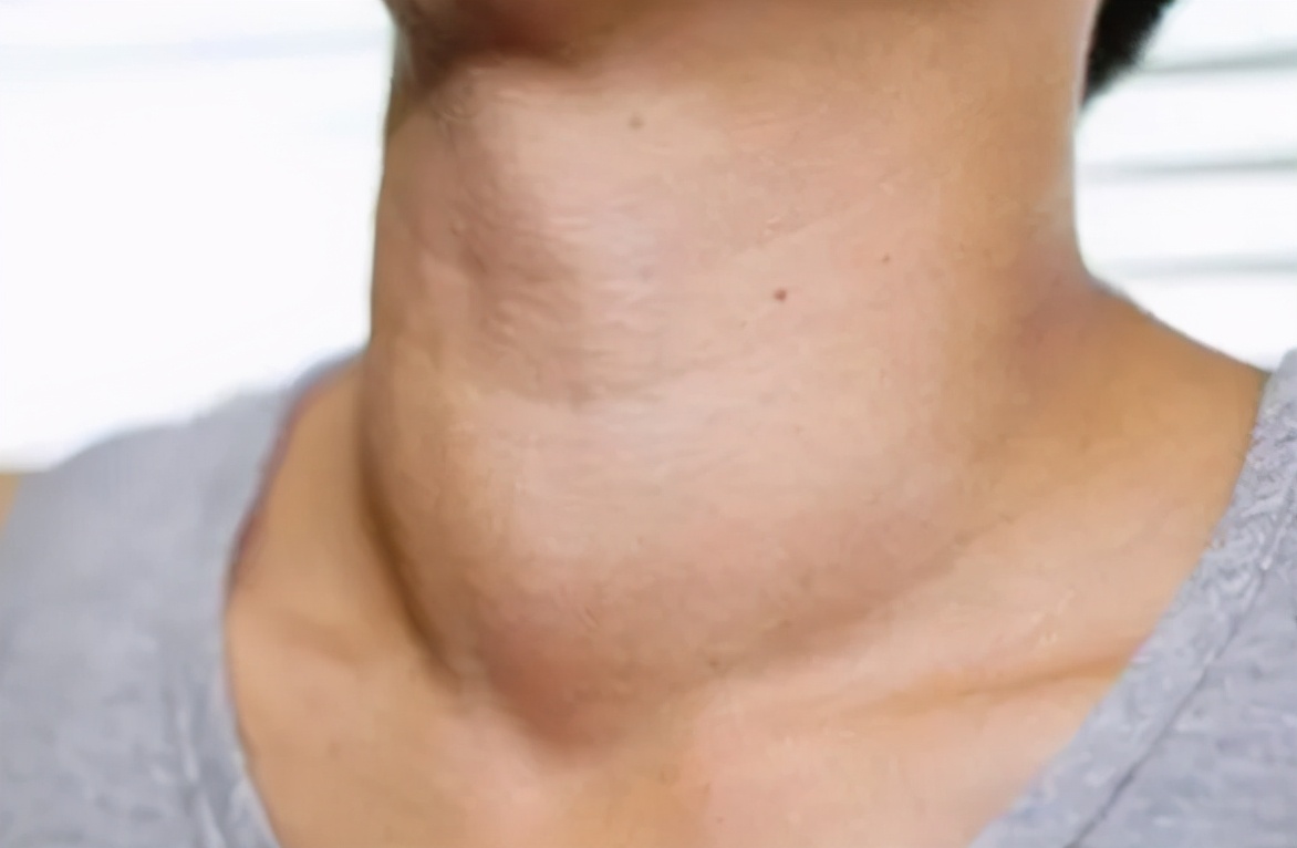 医线天|3种蔬菜已被拉入“黑名单”，转告家人：再爱吃也要忍住，切勿贪嘴