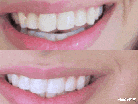 时尚好物官 我国“有”1不起眼牙膏,因价低被忽视,网民:用完牙黄逐渐消失