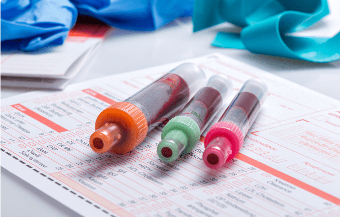 肾衰竭|肌酐升高后如何减缓肾衰竭？稳住2项指标很关键，结果不会差