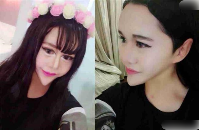丝芙兰 女网红过度减肥瘦成皮包骨，穿泳衣秀身材胸前肋骨清晰可见