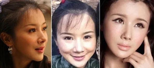 隐婚|被美容针害惨的六位女星，脸僵到哭笑都崩，最惨的直接退圈