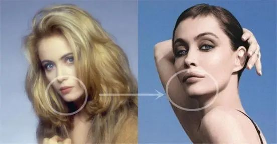 芒果台|昔日「美艳尤物」云端陨落——又一个被「整容」毁了的神颜美女