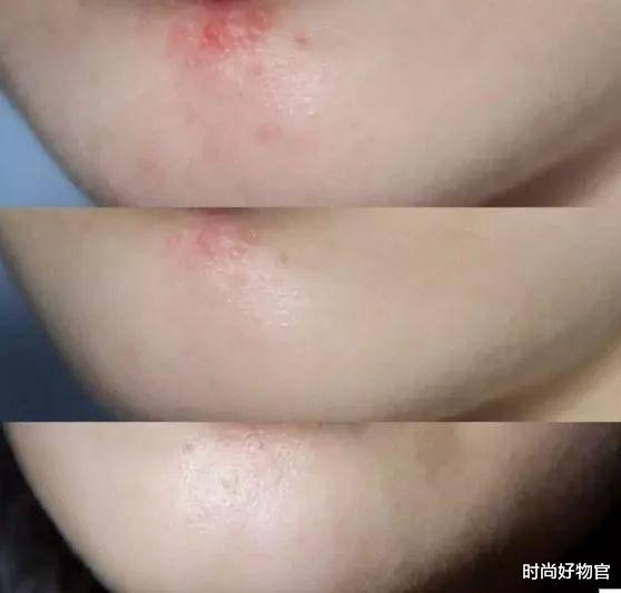 时尚好物官|42岁秦海璐和刘涛合照，皮肤状态似24岁，学她涂片仔癀养出少女肌