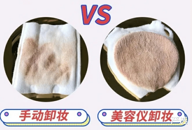 严选|周迅无法面对衰老在家哭，医美抗衰老风险大，如何正确抗衰老？